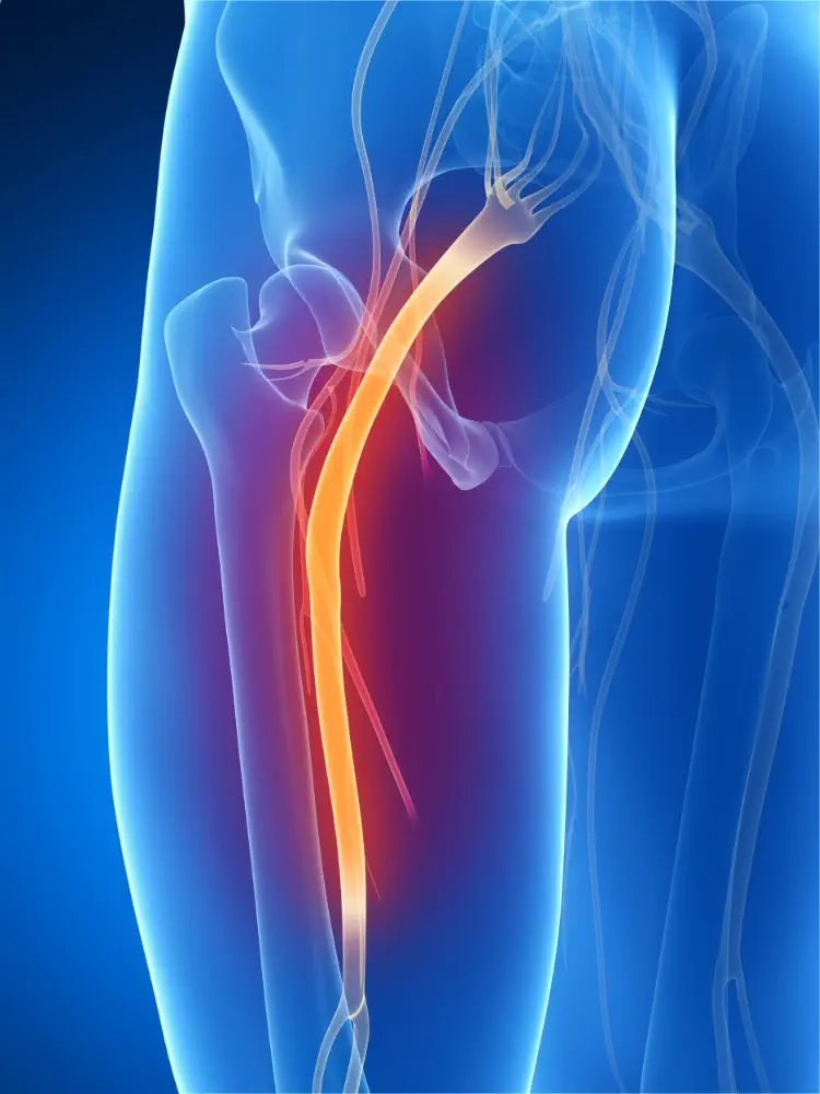 Top-rated leg pain and sciatica doctor in Brooksville FL.